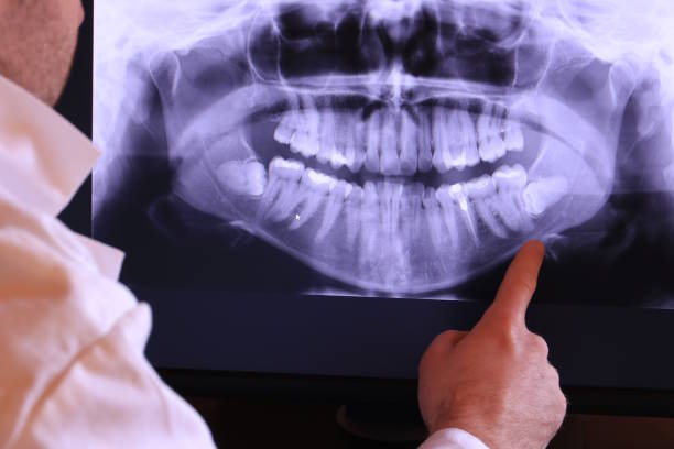 Best Urgent Dental Care for Toothache in South Fulton, TN
