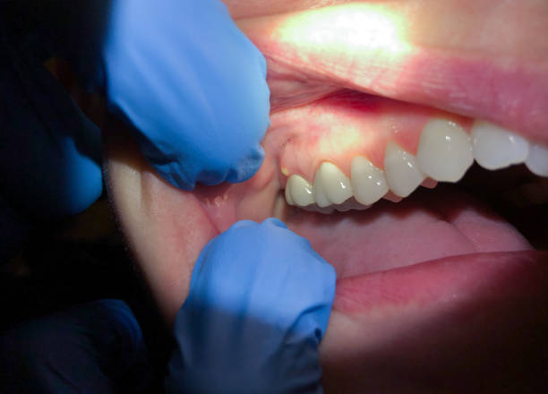 Best Orthodontic Emergency Dentist in South Fulton, TN