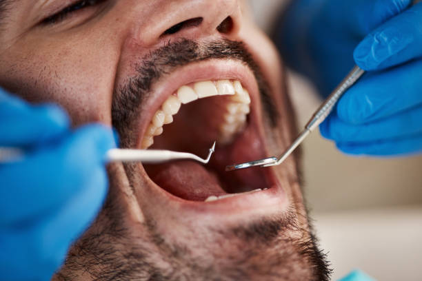 Best Orthodontic Emergency Dentist in South Fulton, TN
